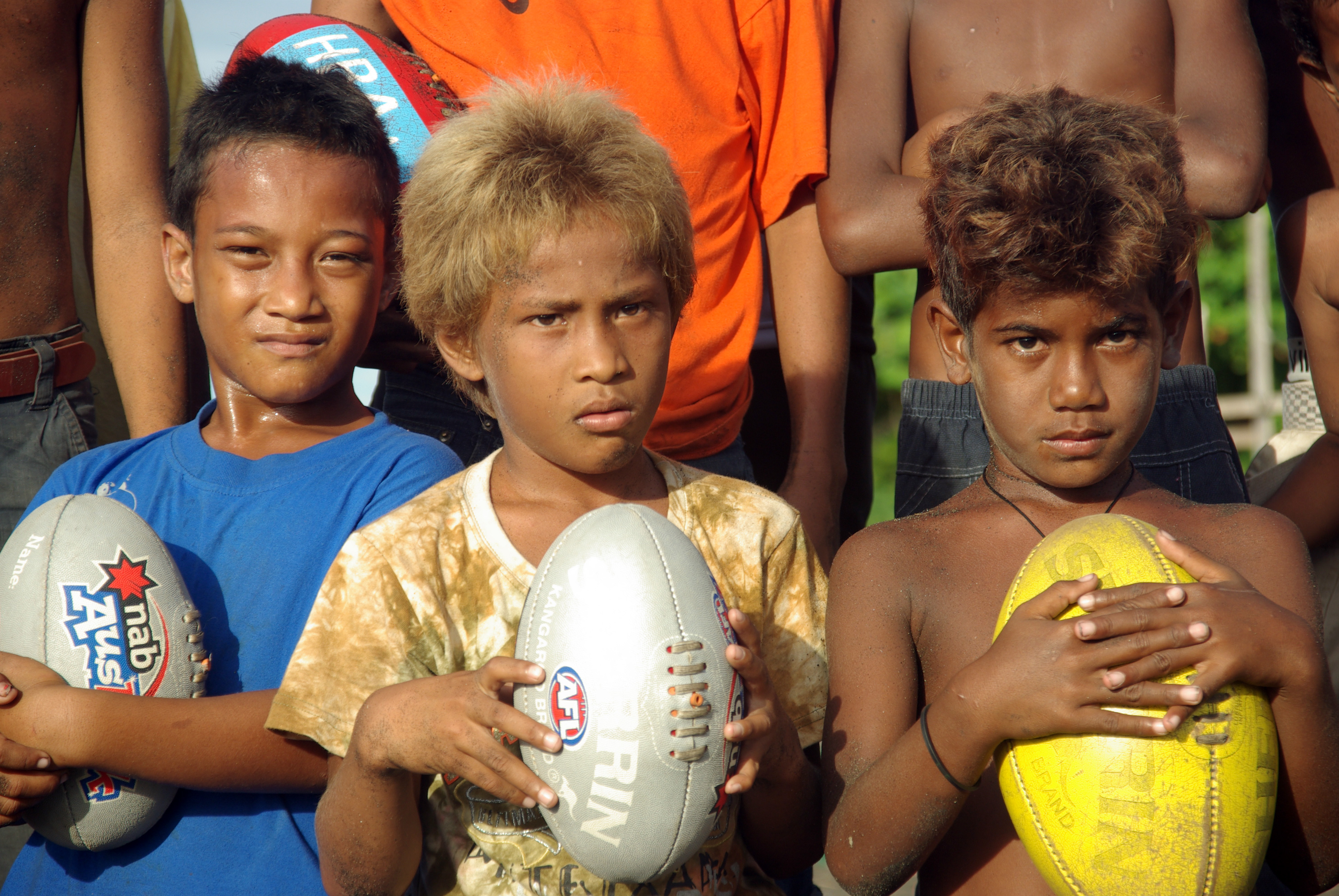 Kanak-kanak lelaki Kepulauan Solomon dari Honiara. Orang yang berambut perang atau perang adalah agak biasa di kalangan penduduk Kepulauan Solomon tanpa sebarang campuran Eropah, terutamanya di kalangan kanak-kanak.