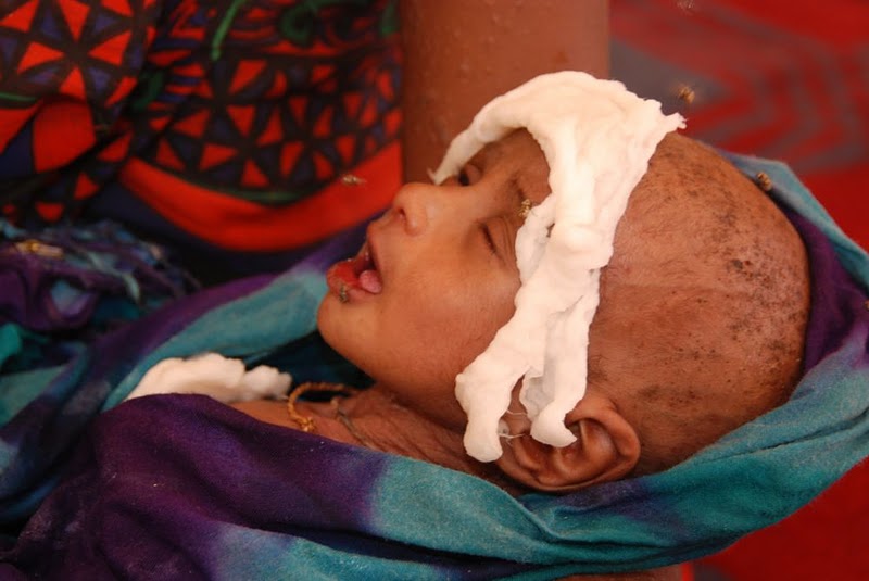 Masalah kelaparan di Somalia.