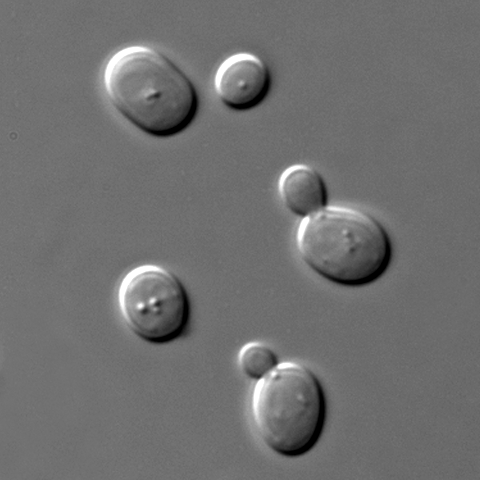 S.cerevisiae : 오른쪽 위는 출아 중