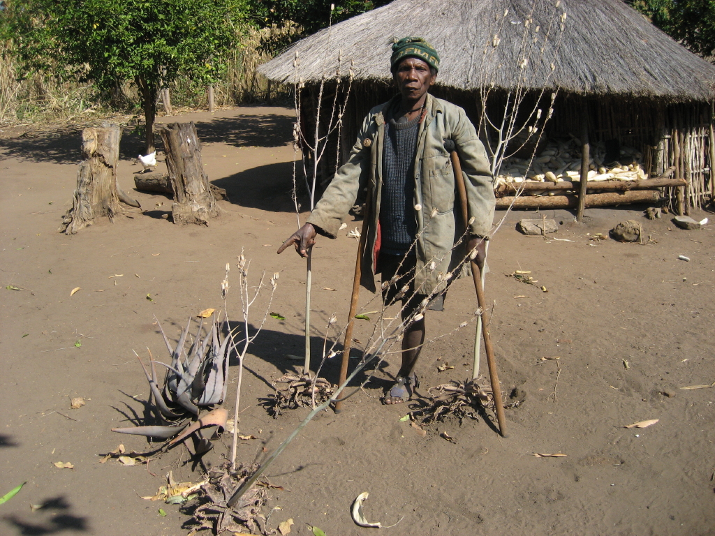 Một nạn nhân bom mìn ở Mozambique. Nội chiến đã để lại vô số bom mìn chưa được gỡ bỏ, gây nguy hiểm cho dân thường.