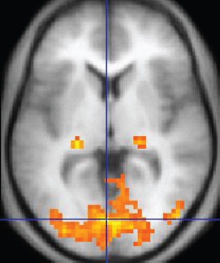 fMRI 영상