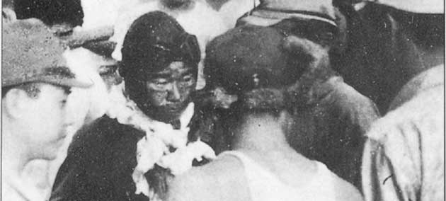 負傷して戦闘から帰還した直後に撮影した写真(ラバウル、1942年8月8日)。坂井は頭部を銃弾で擦過傷を負い、右目は失明、顔は風に曝されて腫れ上がり、焼けただれていた。しかし、治療を受ける前に任務報告を主張した。