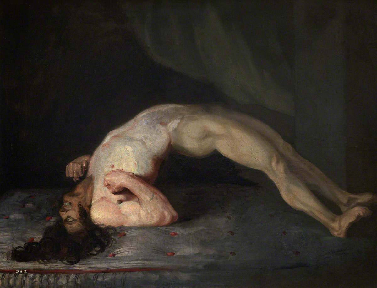 파상풍 환자의 후궁경련을 묘사한 찰스 벨의 그림 (1809)