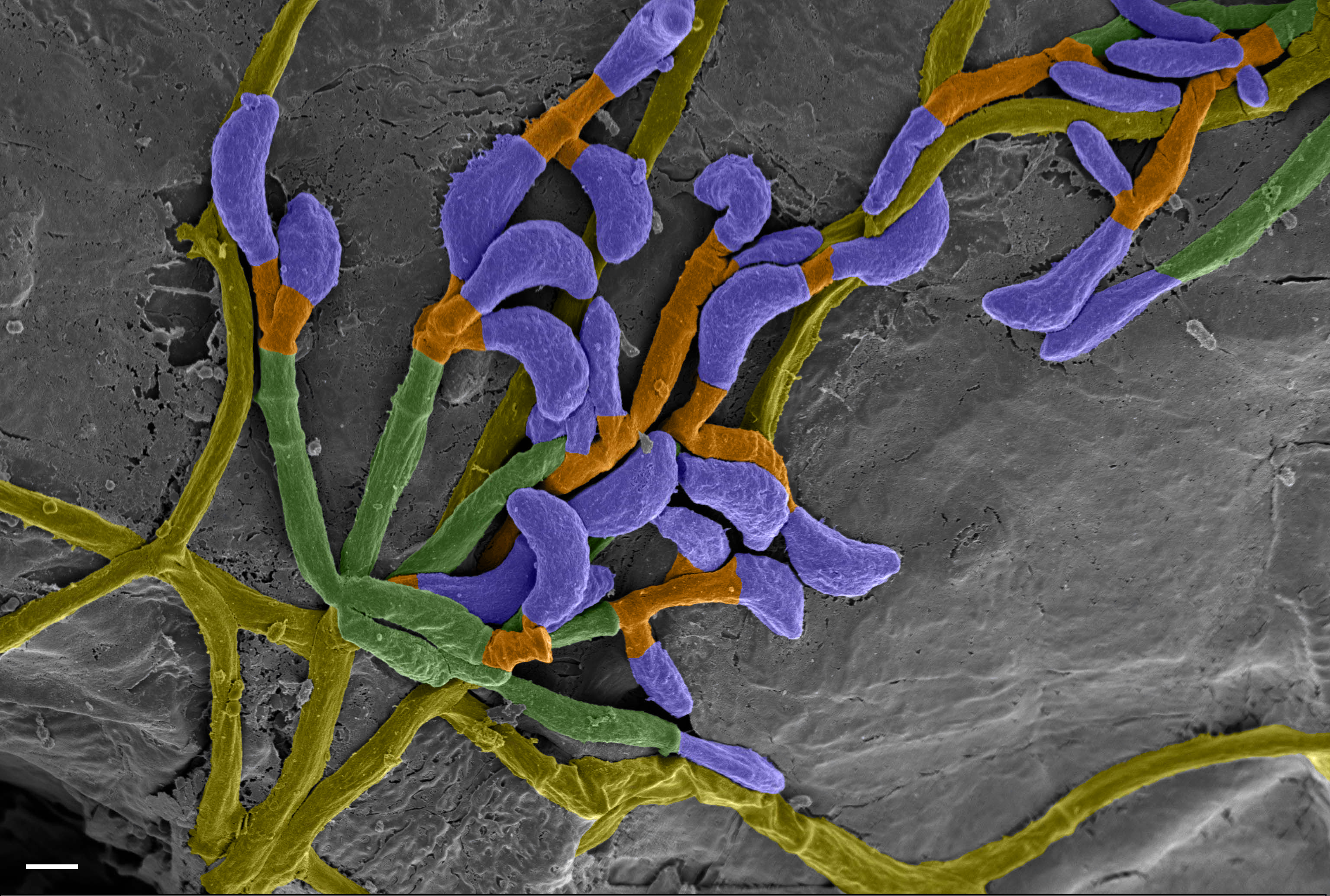 The image depicts a microscopic view of ''P. destructans''